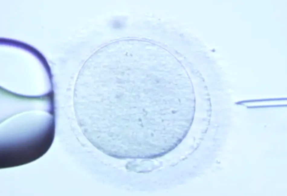 fiv-louise-brown-blog-anhela-fertilidad.png